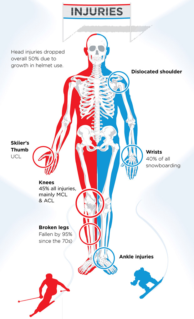 Skiing vs. Snowboarding Was ist gefährlicher? S...